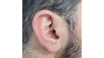 ارزیابی کامل شنوایی