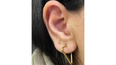 تجویز و تنظیم انواع سمعک