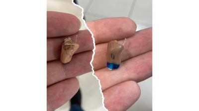 تنظیم مجدد سمعک‌های قدیمی