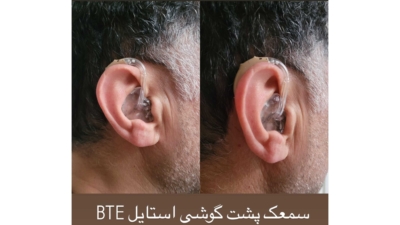 ساخت قالب اختصاصی گوش