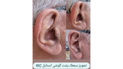 اهمیت غربالگری شنوایی نوزادان 