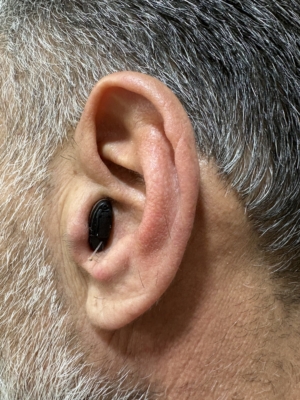 تجویز و تنظیم انواع استایل و رده سمعک